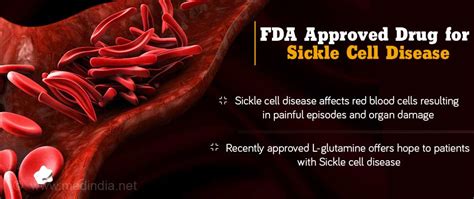 L Glutamine Approved For Sickle Cell Disease