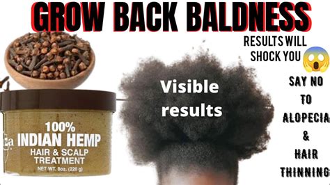 How To Mix Clove Indian Hemp To Grow Back Baldness Alopecia 3 Times