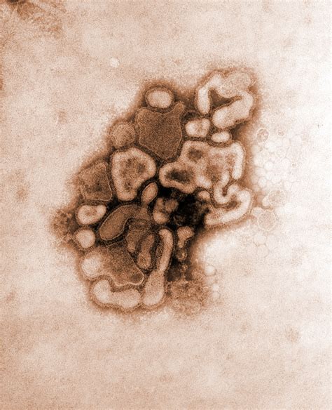 Electron Micrograph Of H1n1 Influenza Virus Biology Of Human World Of Viruses