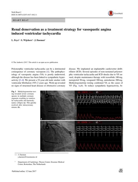 PDF Renal Denervation As A Treatment Strategy For Vasospastic Angina