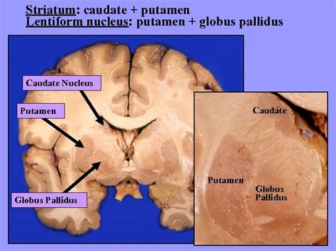 Basal Ganglia Dr G R Leichnetz Basal