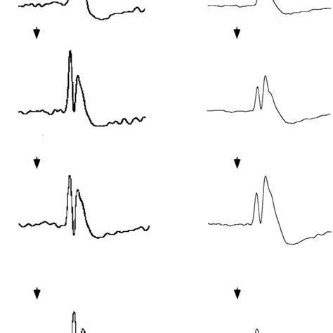 Waveform classification and incidence of individual waveform types as ...