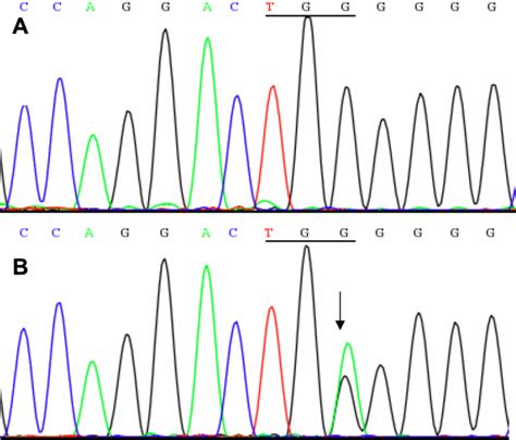 Forward Sequence Analysis Of Crygc A Dna Sequence Chromatograms Of An