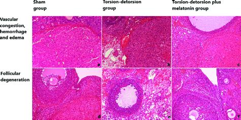 Histological Sections Of Rat Ovaries Stained With Hematoxylin And Eosin