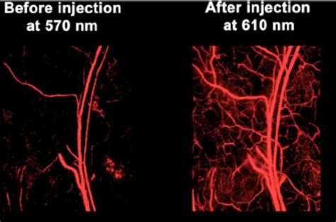 Eb Enhanced Photoacoustic Imaging Of Mouse Ear Microves Sels Pa