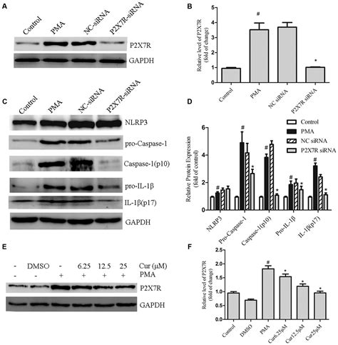 Frontiers Curcumin Represses Nlrp3 Inflammasome Activation Via Tlr4