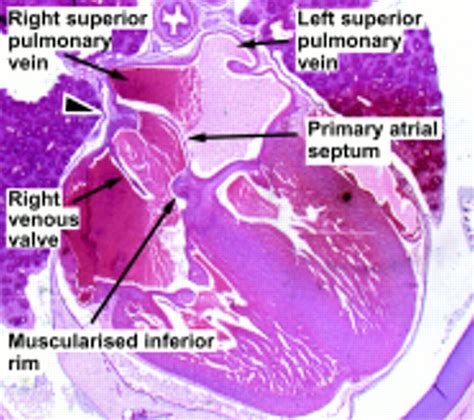 Heart Septum Structure And Function