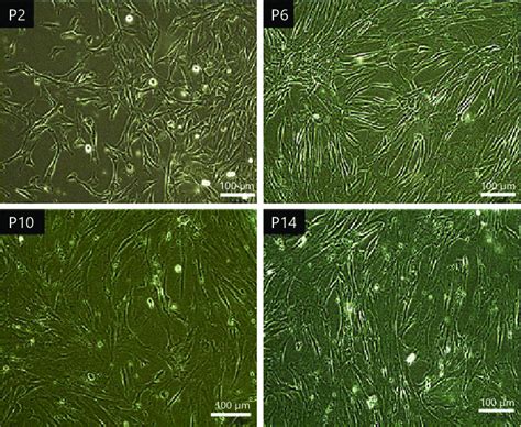 Cell Morphology Of Wj Mscs At Passages Wj Mscs Were Sub Cultured Up To Download Scientific