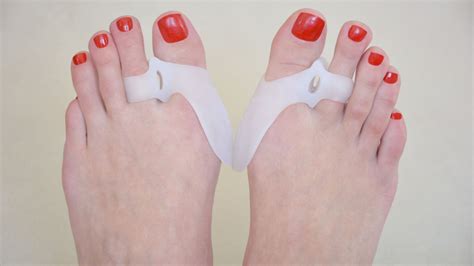 Big Toe Bunion - Symptoms, Causes, and Treatments of Foot Bunion