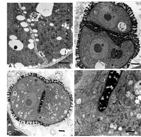 Transmission Electron Micrographs Showing Internal Walls In Tes