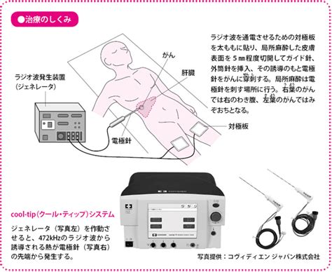 切らない乳がん治療 がんゲノム医療・免疫治療 銀座みやこクリニック院長ブログ