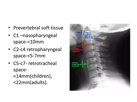 X ray c-spine | PPT