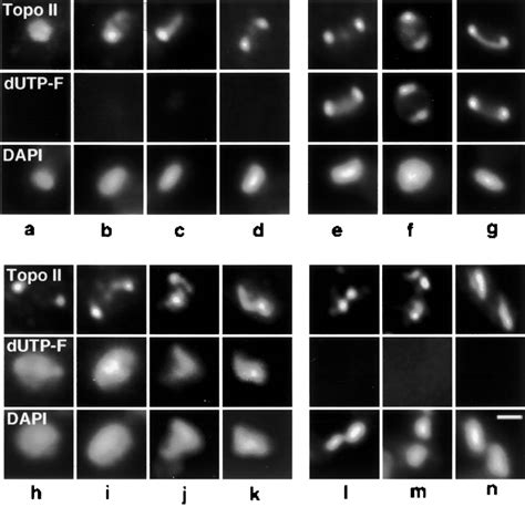 Analysis Of Topo II Localization In Asynchronous Cells Labeled With