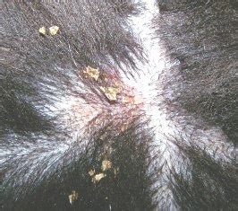 Criadero La Pureza Seborrea En Perros Dermatitis Seborreica