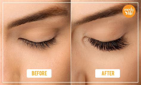 How to Grow Eyelashes Fast in a week with Natural Home Remedies?