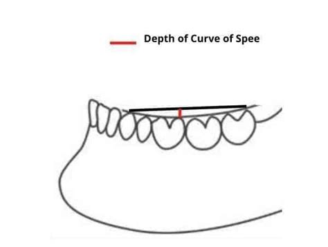 Curve of Spee in Orthodontics - Dental Dictionary