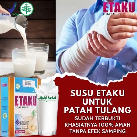 Jual Susu Etaku Untuk Patah Tulang Dan Retak Akibat Terjatuh Atau