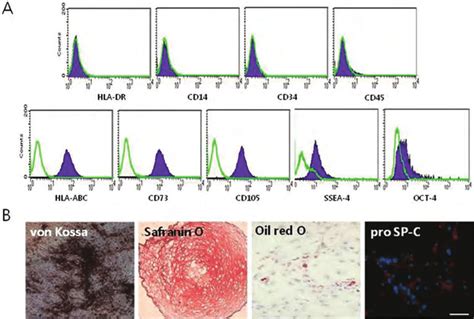 Immunophenotype And Multilineage Differentiation Of Umbilical Cord