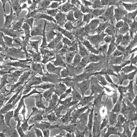 Human Brain Stem Astrocytes - Innoprot Primary Neural Cell System