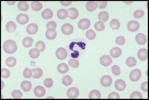 Blood Cell Inclusions Parasites And Artifacts Flashcards Quizlet Hot