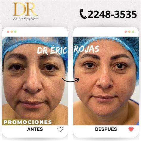 Dr Eric Rojas Dr Eric Rojas Dermatología Laser Center