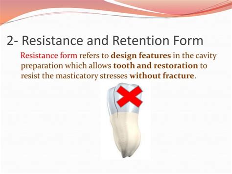 Principles Of Cavity Preparation Ppt