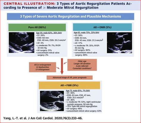 Concomitant Mitral Regurgitation In Patients With Chronic Aortic