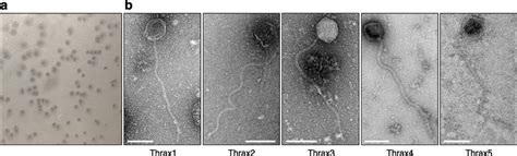 Isolation Of Five Bacillus Phages Thrax A Plaques Produced By