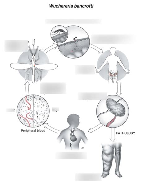 Wucheria Bancroft Lymphatic Filariasis Life Cycle Diagram Quizlet