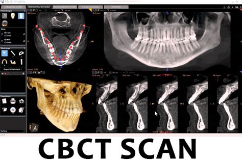 Describe The Purpose And Uses Of Cone Beam Computed Tomography