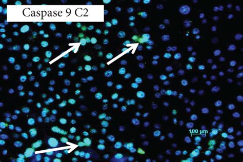 Immunofluorescence Caspase 9 P53 And Bax A Control Cells Showing