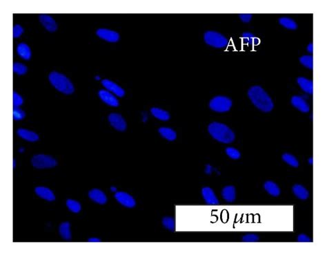 Immunocytochemical Analysis Of Hepatocyte Specific Marker Expression