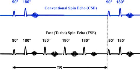 Tsefse Questions And Answers In Mri