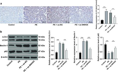 Snhg Overexpression Suppresses Autophagy In Pe Mice Pcdna Snhg