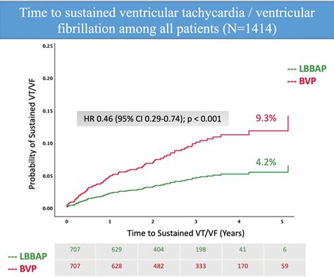 Arrhythmic Risk In Biventricular Pacing Compared With Left Bundle