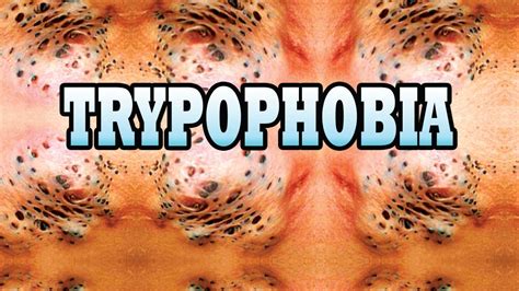 Where Do I Learn about Trypophobia? Visit Trypophobia911.com - YouTube