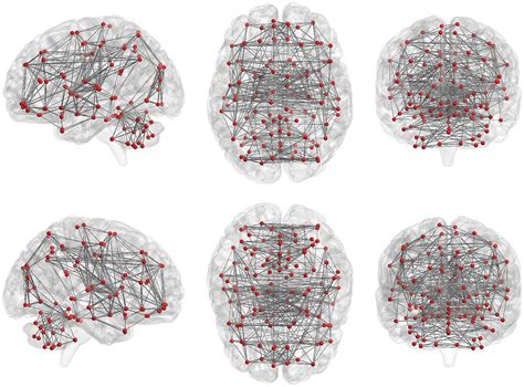 Resting State Functional Mri Everything That Nonexperts Have Always