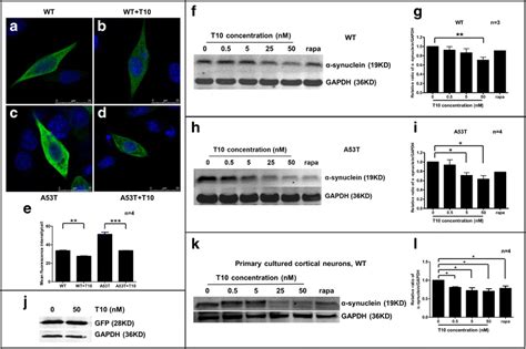 T10 reduces the expression of α synuclein in MN9D cells and cortical