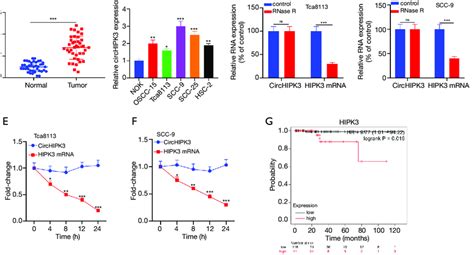 The Expression Of Circhipk In Normal And Cancerous Tissues Of Oscc