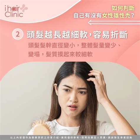 女性雄性禿的判斷方法1次掌握3個女性雄性禿原因帶你了解 Ihair風華御髮