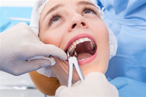 Señales De Que Es Necesaria Una Extracción Dental Clínica Dental Inés Iranzo En Valencia