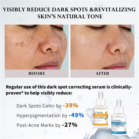 Dark Spot Remover And Corrector For Face With Vitamin C Hyaluronic Acid And Active Ingredients