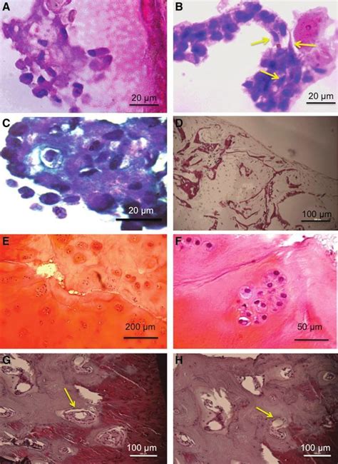 A Hematoxylin And Eosin H E Stained Section Of Tissue Engineered