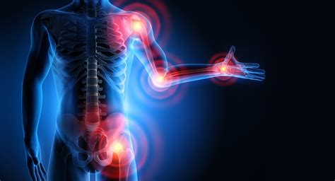 Soft Tissue Sarcoma Symptoms, Facts, Diagnosis, and Treatment | MD ...