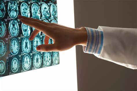 Idaho Traumatic Brain Injury Lawsuits What You Need To Know