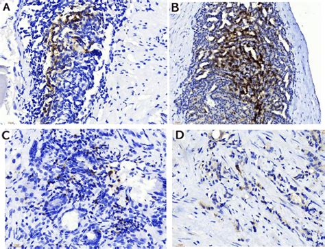 Representative Immunohistochemical Ihc Staining Of Pd And Pdl In