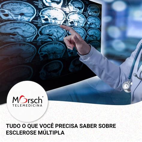 Cardiologista A esclerose múltipla EM é uma doença autoimune