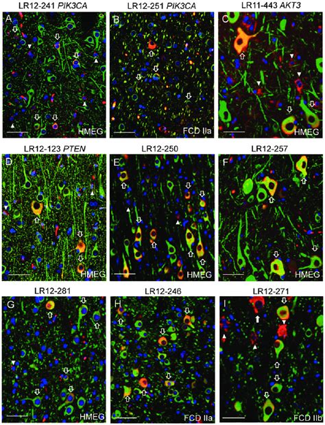 Phosphorylated Ribosomal S6 Protein Phospho S6 Immunofluorescence In