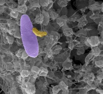 Microbio Bacterias Vampiro Depredadoras Que Se Comen A Otras Bacterias