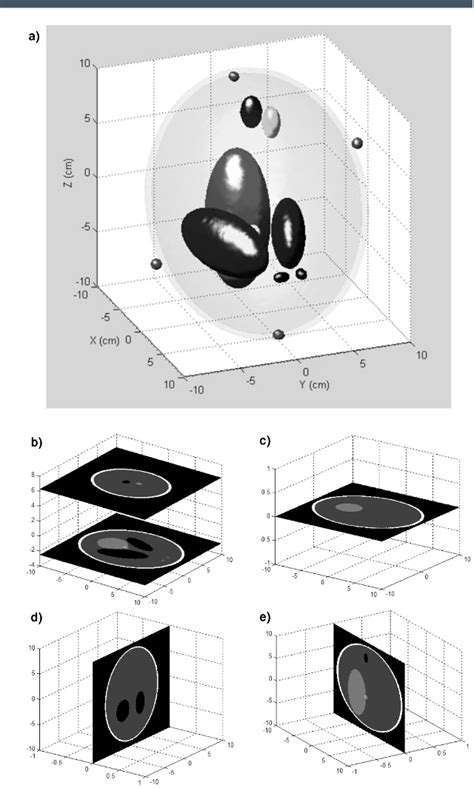 Figure 1 From Mitigating Motion Artifacts In Fdk Based 3 D Cone Beam